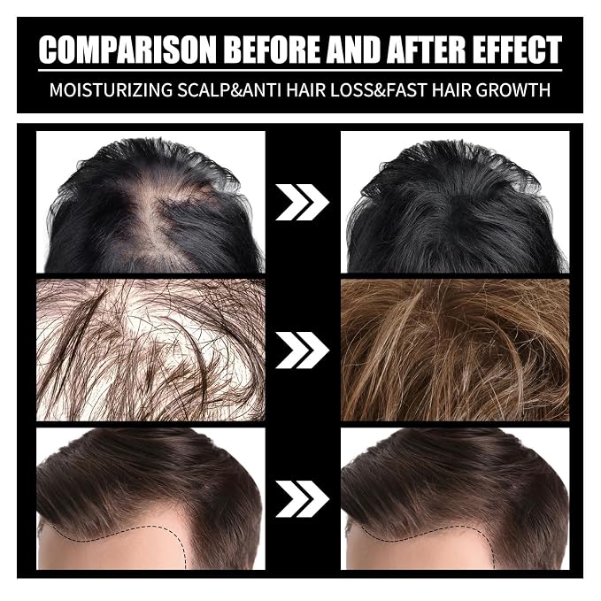 Biotin Hair Growth Serum Oil,Hair Supplement,1PCS）