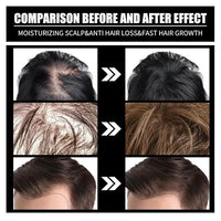 Biotin Hair Growth Serum Oil,Hair Supplement,1PCS）