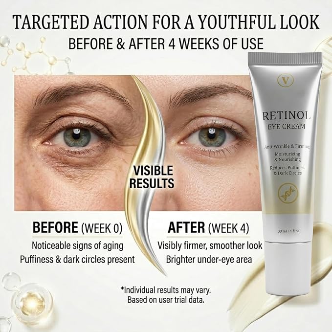Retinol Under Eye Cream for Dark Circles and Puffiness, 1 Fl Oz | Retinol Eye Cream for Fine Lines, Firming & Moisturizing Skin Care Formula for Women & Men