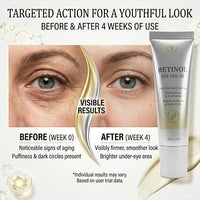 Retinol Under Eye Cream for Dark Circles and Puffiness, 1 Fl Oz | Retinol Eye Cream for Fine Lines, Firming & Moisturizing Skin Care Formula for Women & Men