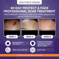 Advanced Scar Treatment with Silishield® & SPF 30 10g – Made in the USA
