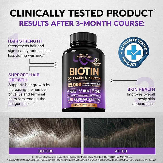 Biotin | Collagen | Hyaluronic Acid | Keratin - Hair Growth & Strength Support Vitamins - Skin & Nails Supplement - Clinically Tested for Men & Women - 25000mcg Vitamins B1, B2, B3, B6 & B7 - 60 Caps