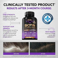 Biotin | Collagen | Hyaluronic Acid | Keratin - Hair Growth & Strength Support Vitamins - Skin & Nails Supplement - Clinically Tested for Men & Women - 25000mcg Vitamins B1, B2, B3, B6 & B7 - 60 Caps