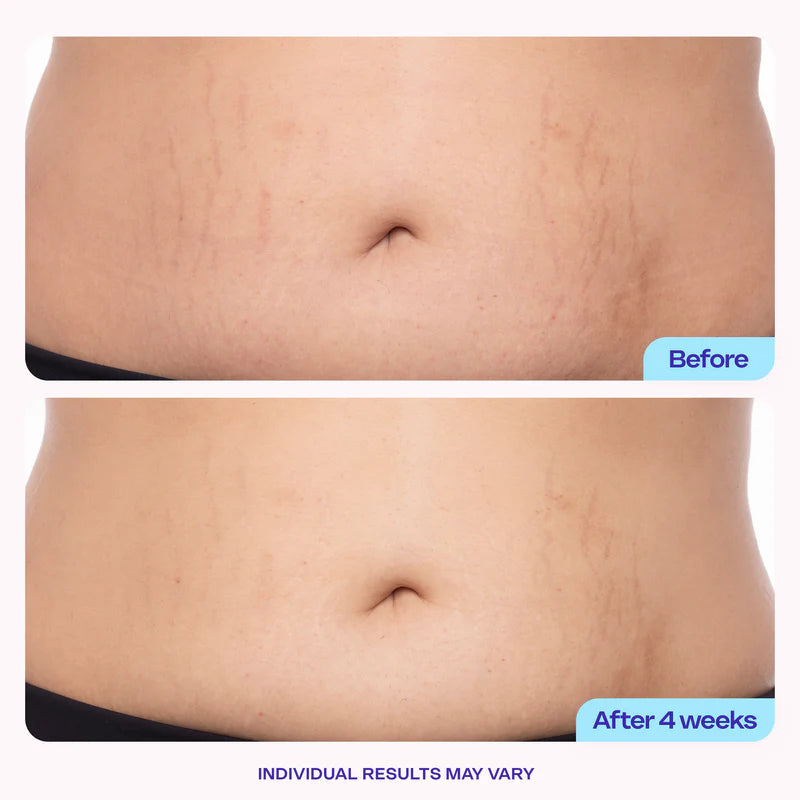Go pure Belly Tightening Duo