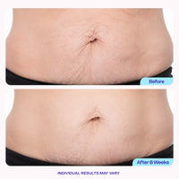 Go pure Belly Tightening Duo