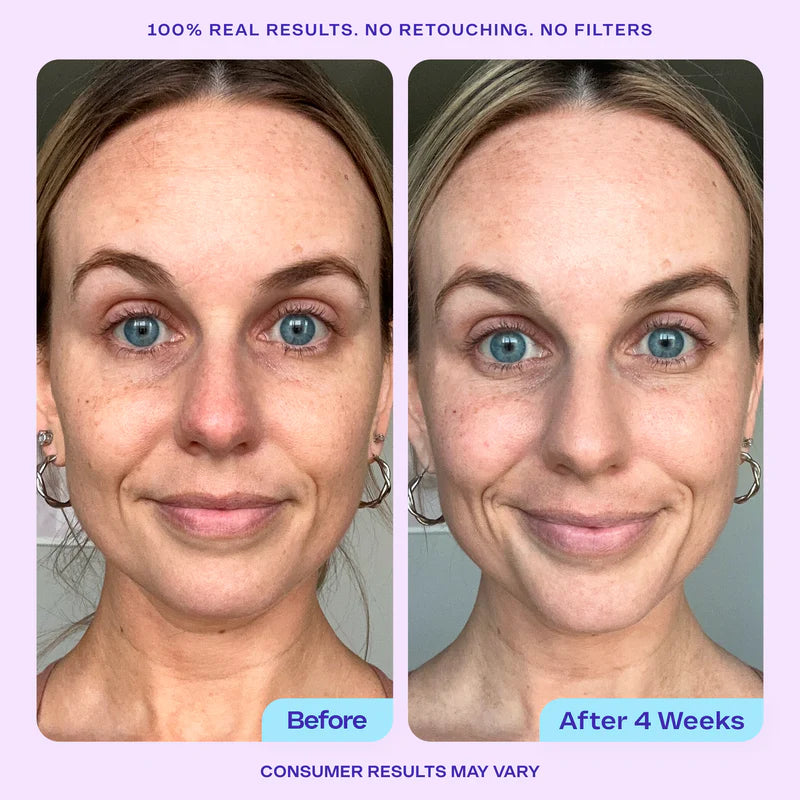 GOPURE Wake Up Radiant AHA Peel