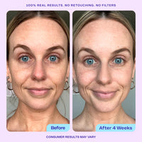 GOPURE Wake Up Radiant AHA Peel